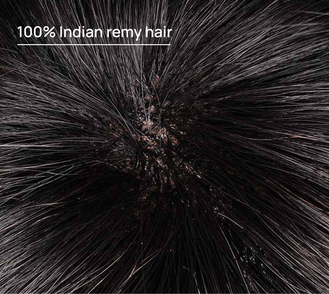 Mono Plus Hair System: A durable & versatile system for men