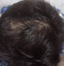 After