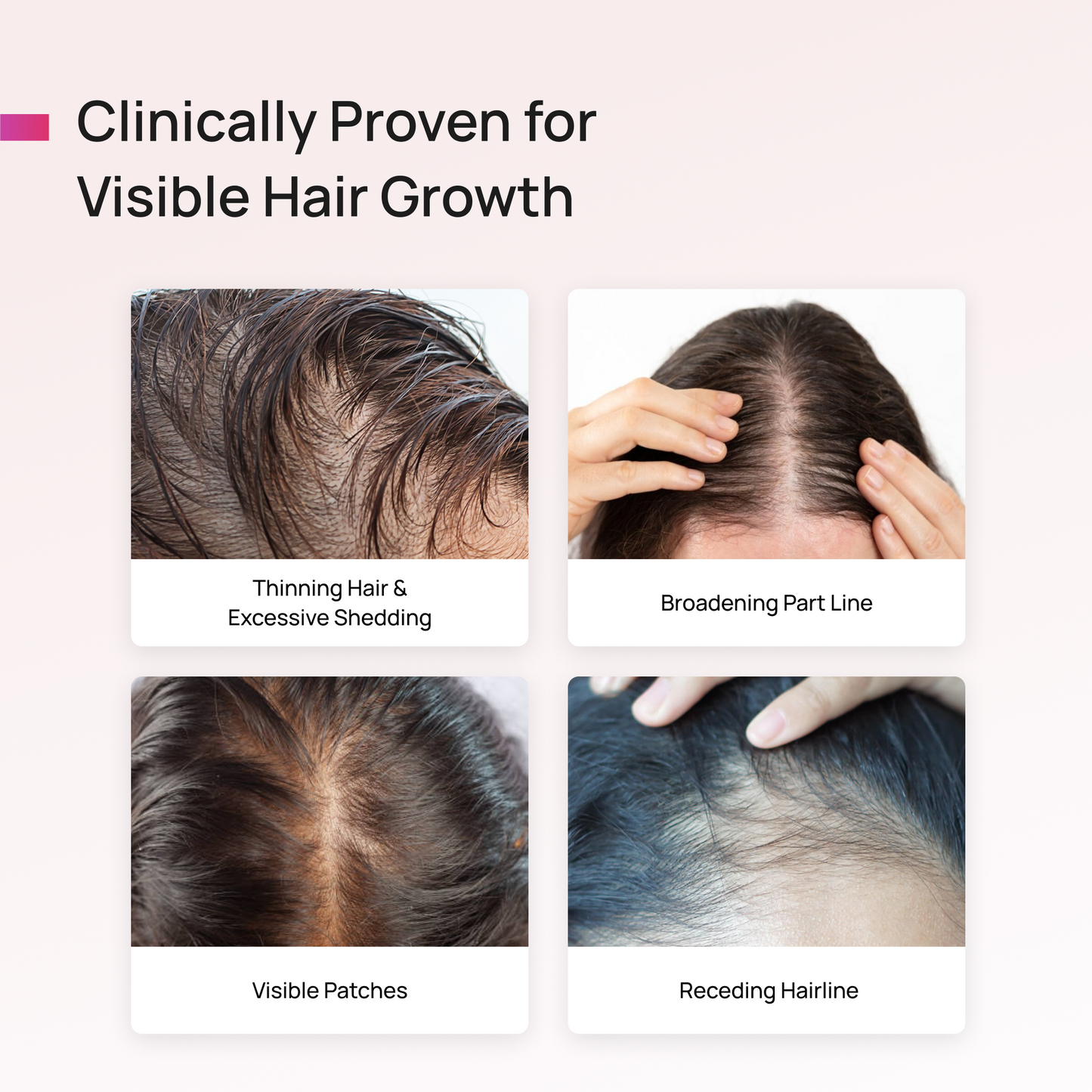 ANAGROW® – Advanced Hair Regrowth Serum with Apple Stem Cells