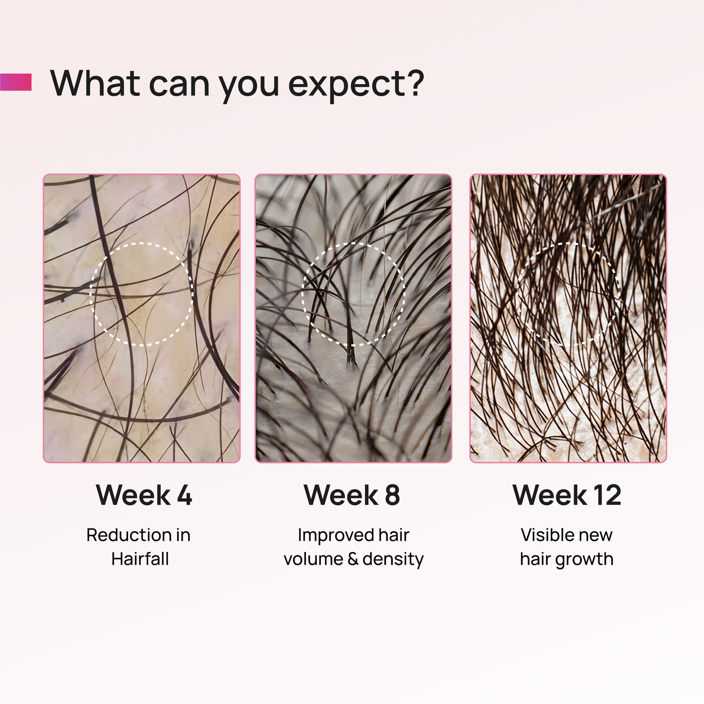 ANAGROW® – Advanced Hair Regrowth Serum with Apple Stem Cells