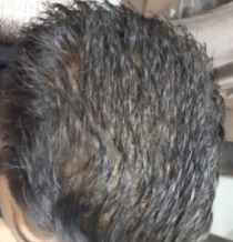Before