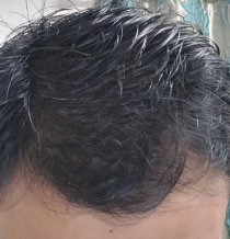 After
