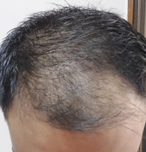 Before
