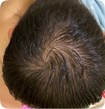 Before