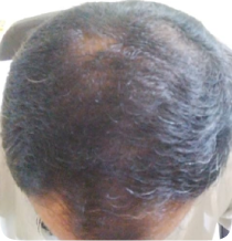 After