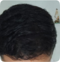 After
