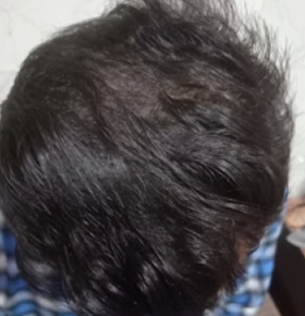 After