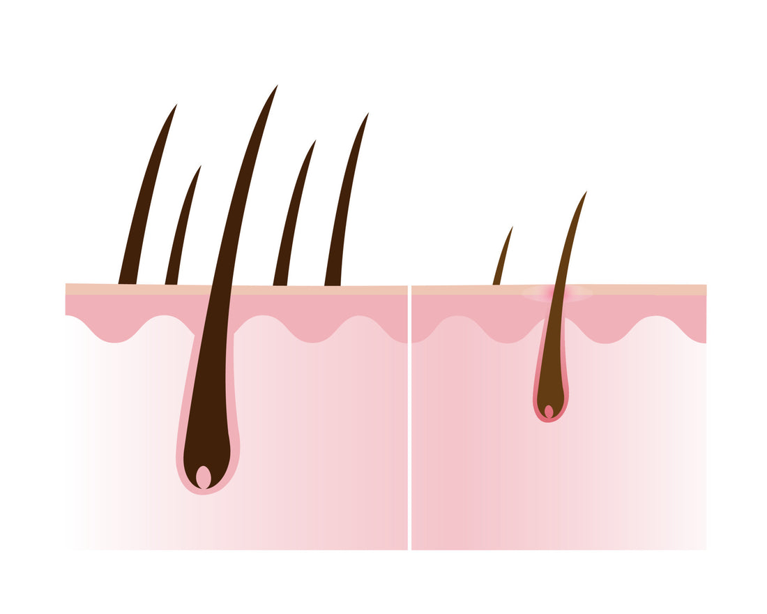 Why Scalp is the Foundation of Healthy Hair Growth?