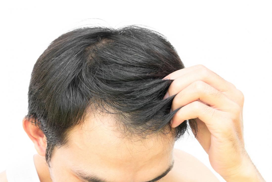 9 Tips for Men to Maintain a Healthy Scalp and Encourage Hair Growth
