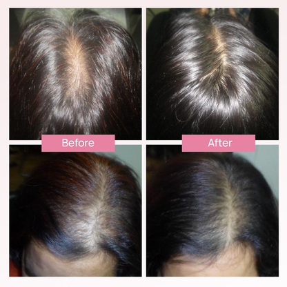 ANAGROW® – Advanced Hair Regrowth Serum with Apple Stem Cells