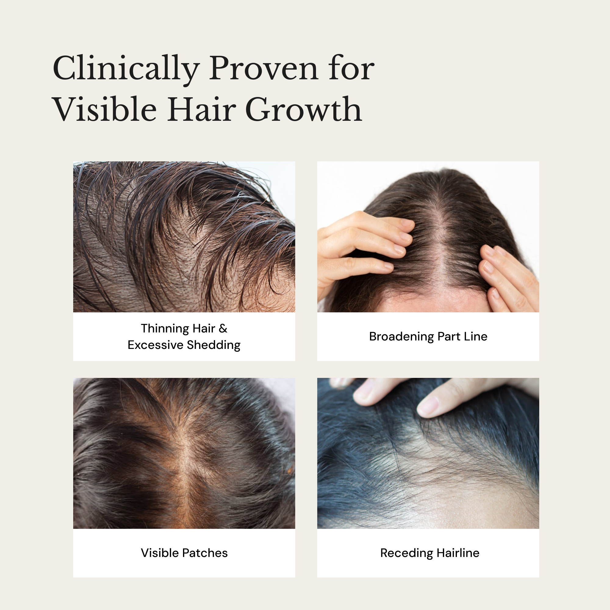 ANAGROW® – Advanced Hair Regrowth Serum with Apple Stem Cells