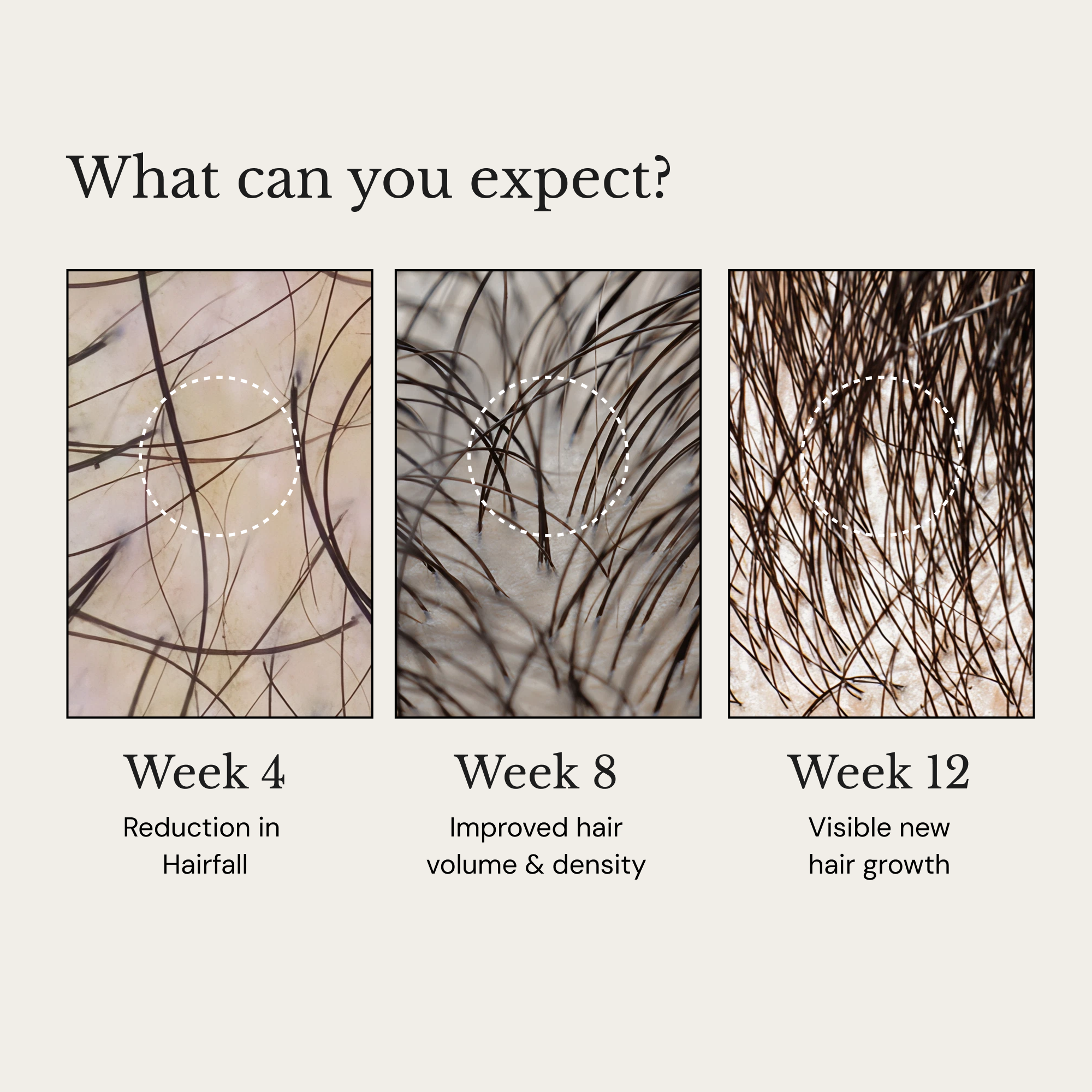 ANAGROW® – Advanced Hair Regrowth Serum with Apple Stem Cells